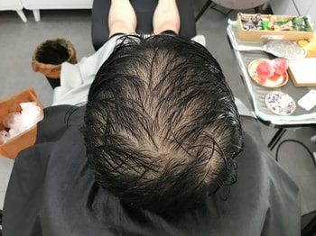 시술 전 젖은 상태