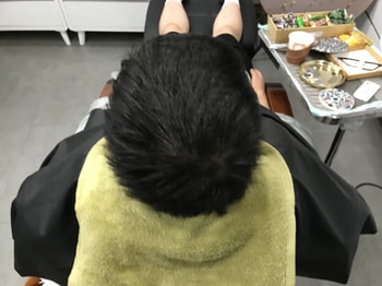 시술 후 말린 상태