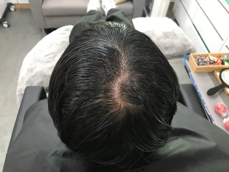 渐变圆点技法头皮纹身后期。