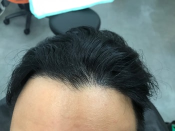 리터치전입니다.