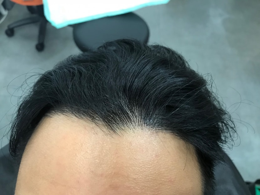 리터치전입니다.