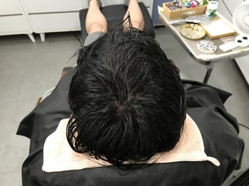 시술후 물 묻히고