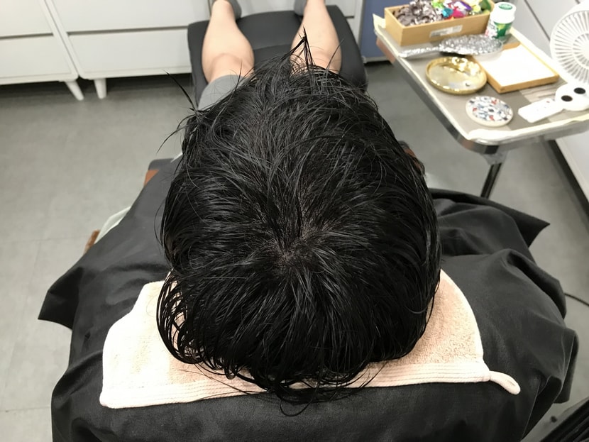 시술후 물 묻히고