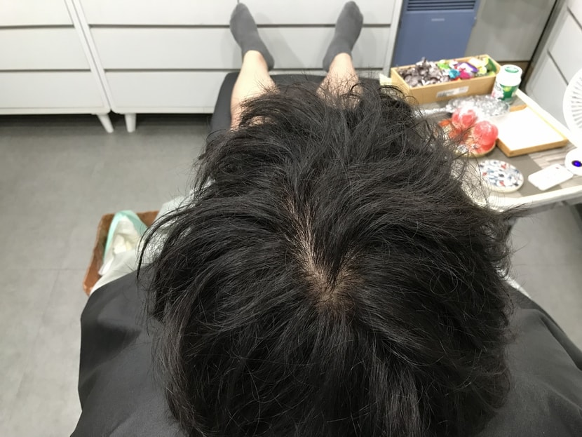 시술전 물 묻히기 전