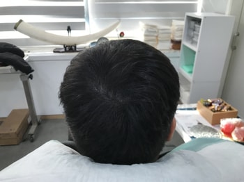 리터치후2