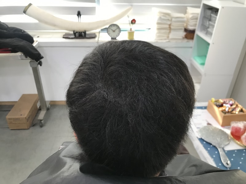 1차리터치후기