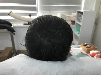 리터치후1