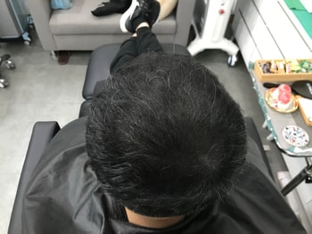 시술샴푸후 드라이로 말린모습