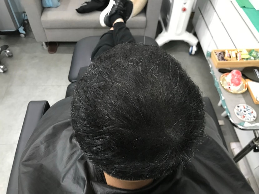 시술샴푸후 드라이로 말린모습
