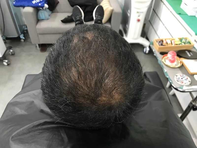 延世美人后记