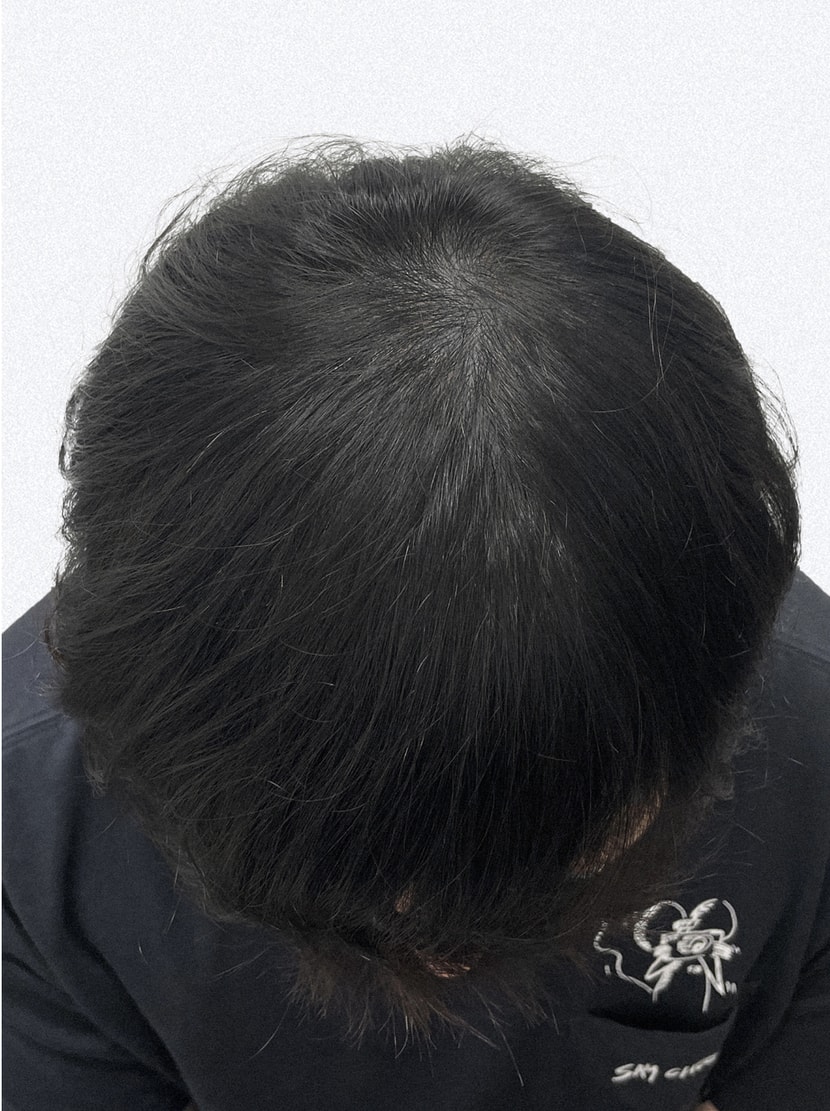 이번 리터치 받은 사진
