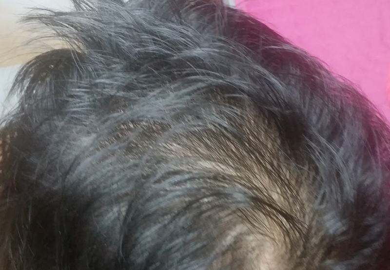 두피문신 후기입니다.