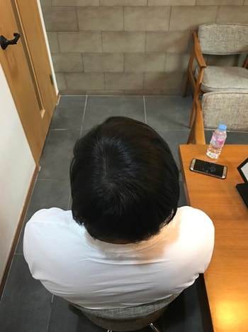 후