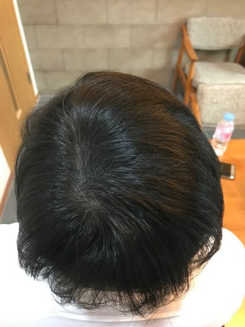 후