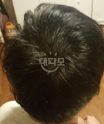 리터치 후