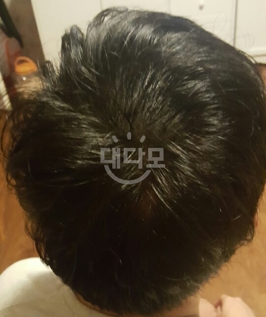 리터치 후
