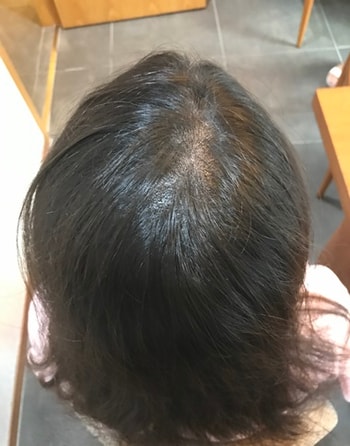 후