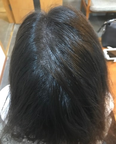 후