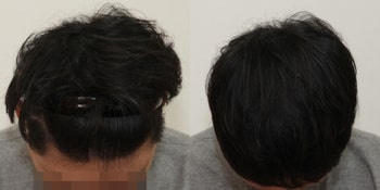 리터치한 뒤 중간체크 때 사진