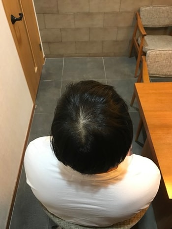 전