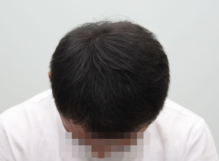후1.jpg