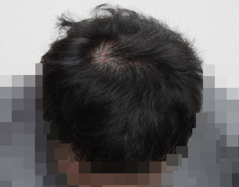 SMP 후기입니다.