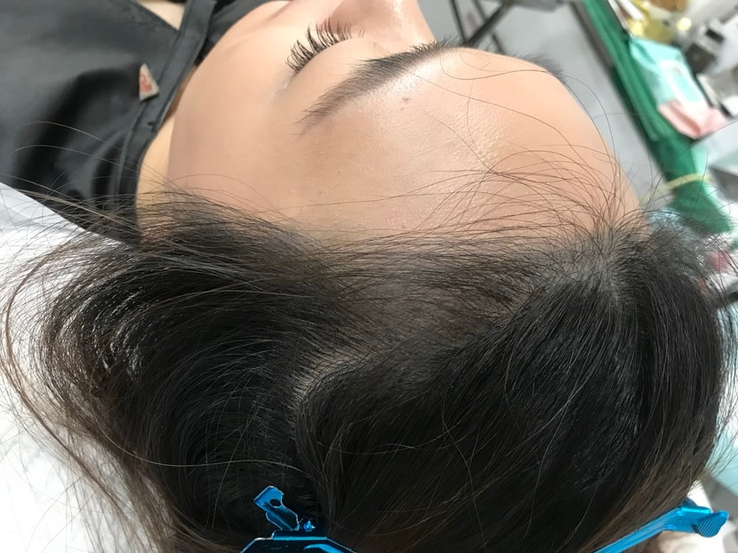 최근 