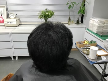 시술 후 말렸을 때