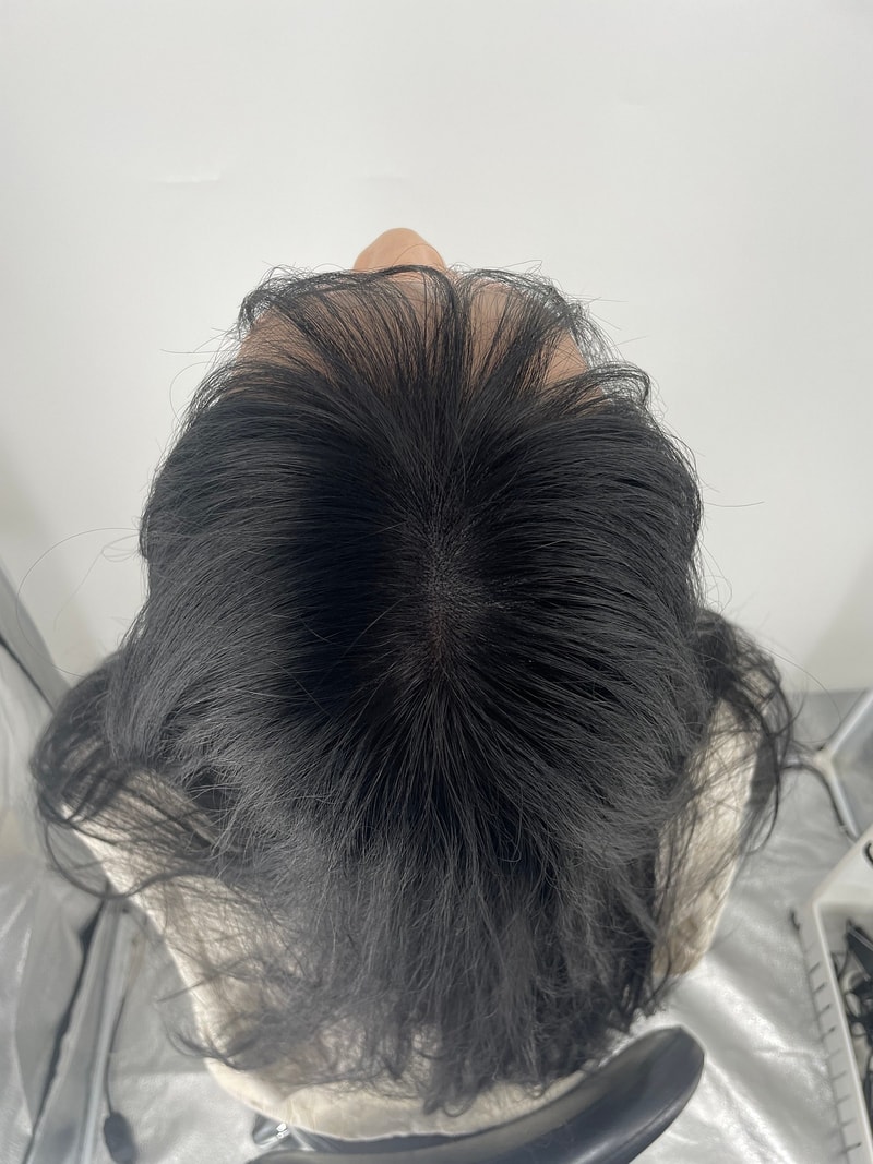 강남 두피문신 뉴헤어에서 시술 받았습니당