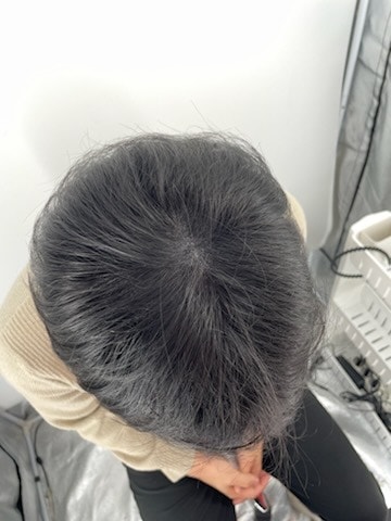 강남 뉴헤어 두피문신 모두에게 추천 드려요