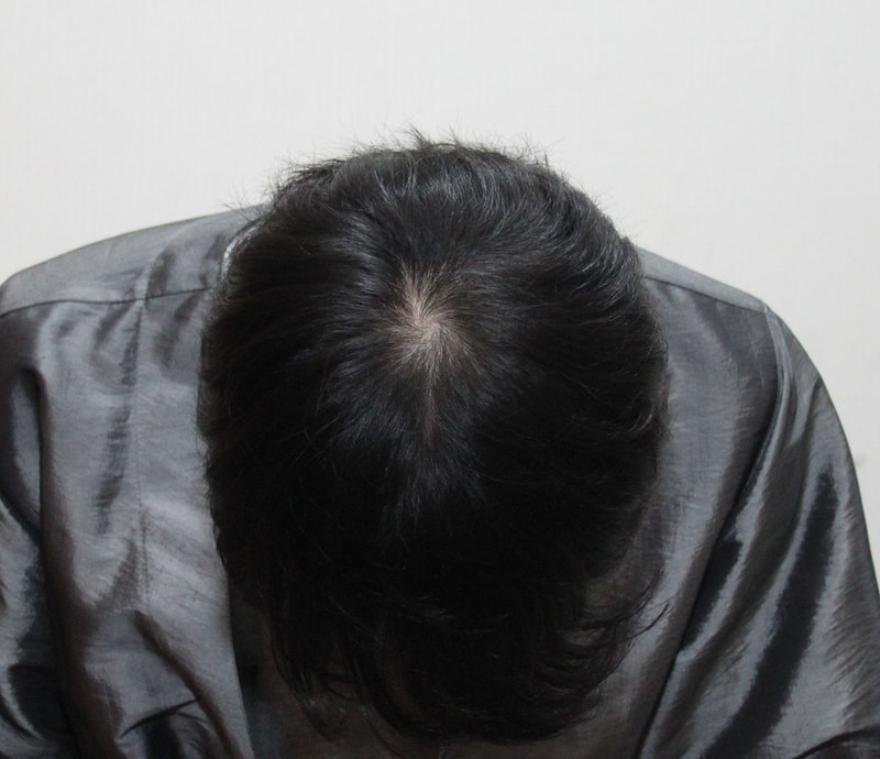 두피문신 만족스럽습니다