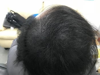 투톤그물기법으로 리터치