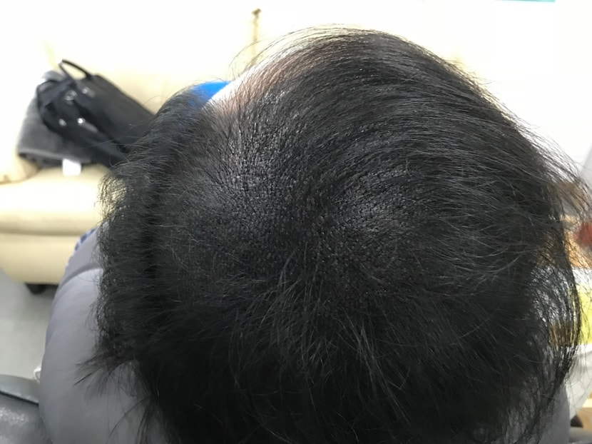 투톤그물기법으로 리터치