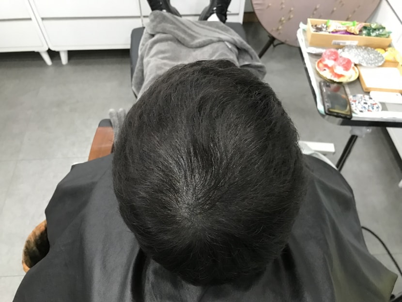 2차전