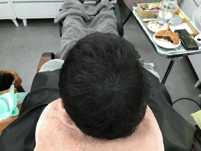 2차후