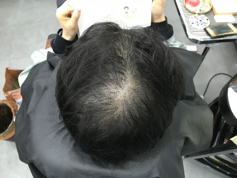 전5