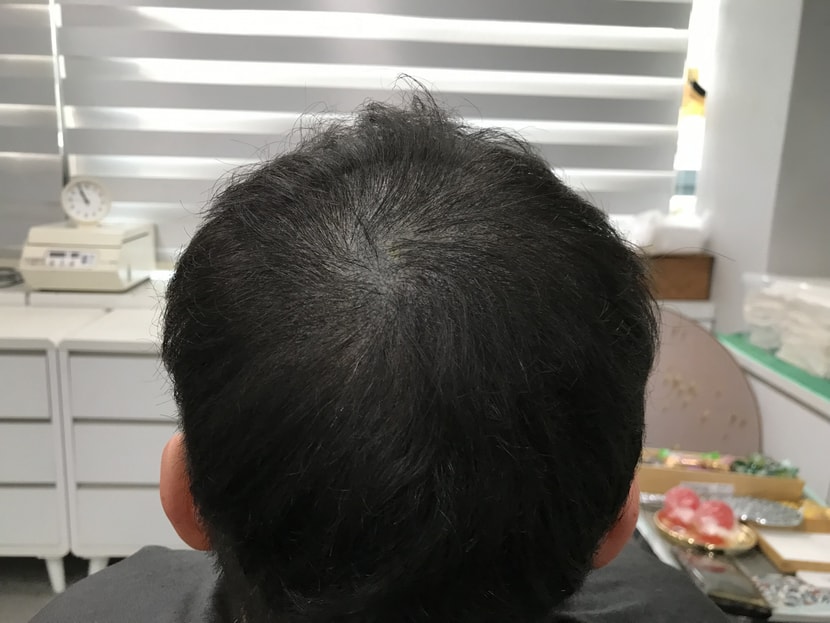 2차전