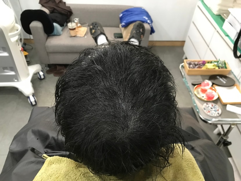 1차보강 후