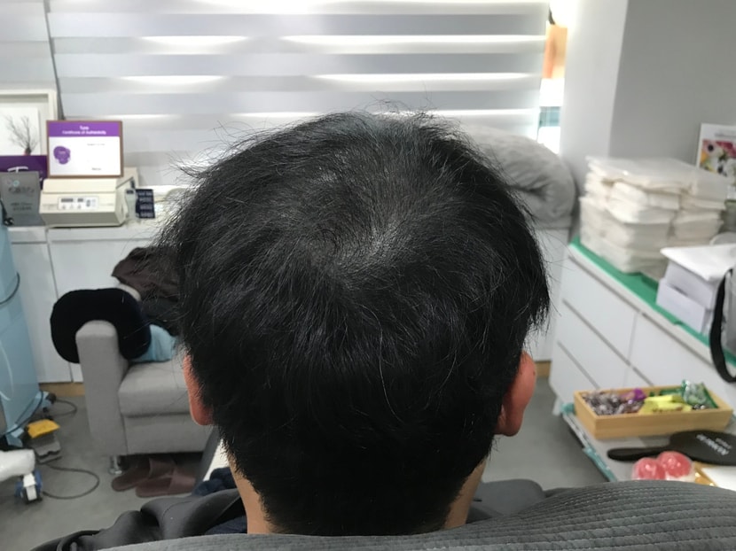 1차보강 전