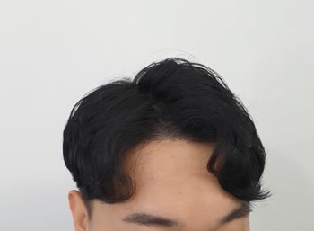 우연히 두피문신 알게되서 두피문신을 받았는데 너무만족합니다 가르마 타는거 생각도 못했는데 전혀 비어보이지않아서 너무좋아요 헤어라인문신하고 너무만족해서 가르마랑 정수리도 두피문신 받았어요
