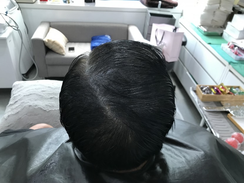 리터치 전
