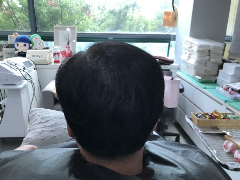 리터치 후