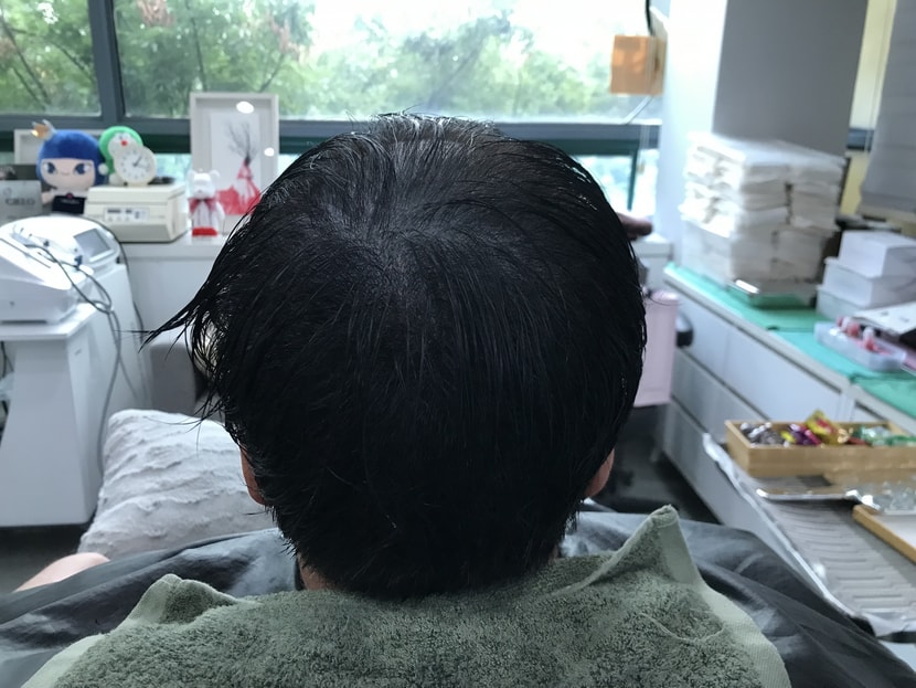 후