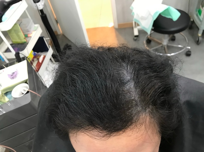 리터치 전