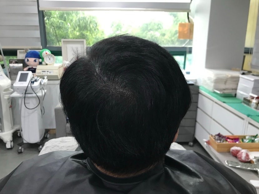 리터치 전