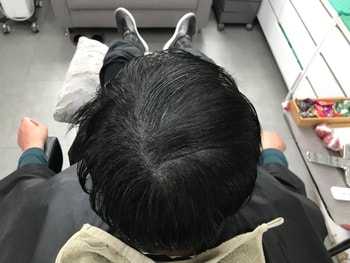 리터치 후