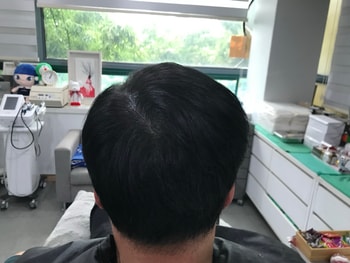 리터치 후