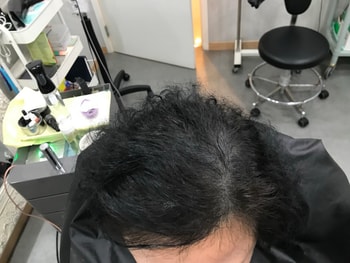 리터치 후