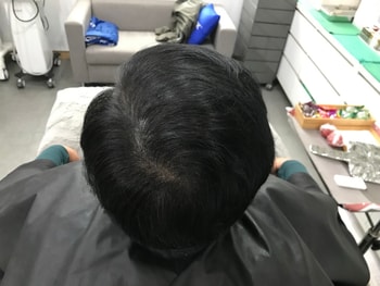 리터치 전