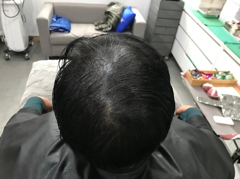 리터치 전